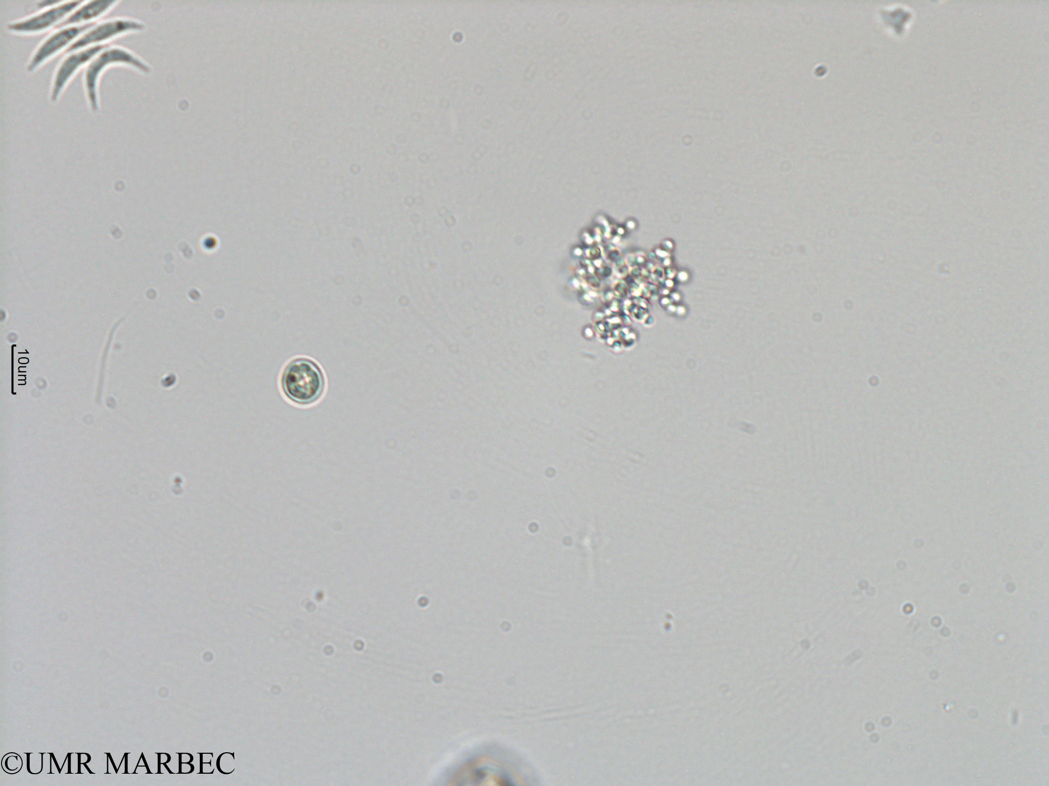 phyto/Mayotte/dziani/DZIANI 2007-2016/Aphanocapsa sp8 (Effluent2012_chrooococcus sp).tif(copy).jpg